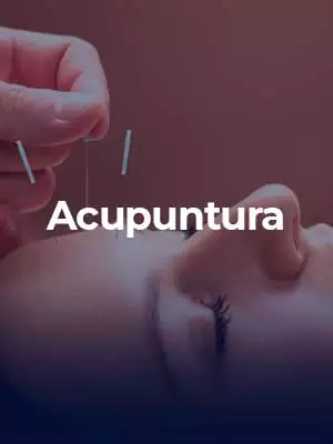 tecnica_de_acupuntura_aprendida_no_curso