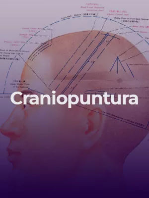 acupuntura-craniopuntura